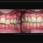 3V Dental Associates Of Port Washington Cosmetic Dentist in Port Washington