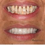 Abq Dental Implant Center Cosmetic Dentist in Albuquerque