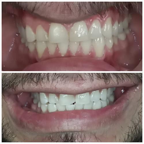 Negocio Abq Teeth Whitening