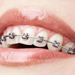 Advanced Dental Wellness Cosmetic Dentist in Columbus