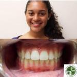 Aesthetic Dental Cosmetic Dentist in North Bergen