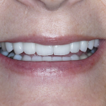 Aesthetic Smiles Family & Cosmetic Dentistry Cosmetic Dentist in Portland