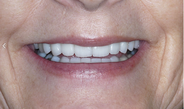 Aesthetic Smiles Family & Cosmetic Dentistry