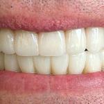 Apex Dental Cosmetic Dentist in Albuquerque