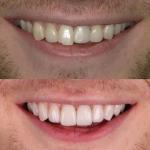 Austin Artistic Dental Cosmetic Dentist in Austin