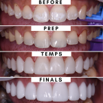 Austin Cosmetic Dentistry By Tejas Patel, Dds Cosmetic Dentist in Austin