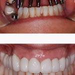 B Dental Spa At Bogota Cosmetic Dentist in Bogota