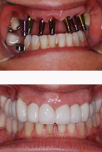 Negocio B Dental Spa At Bogota