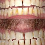 Ballwin Dentist - Angelina Anisimova, Dds Cosmetic Dentist in Manchester