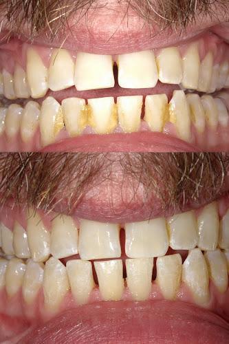 Negocio Ballwin Dentist - Angelina Anisimova, Dds