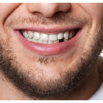 Ben Spiger Dds Cosmetic Dentist in Helena