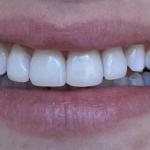 Beyond Dentistry Of Nashua Cosmetic Dentist in Nashua