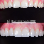 Biltmore Cosmetic & Restorative Dentistry Phoenix Cosmetic Dentist in Phoenix