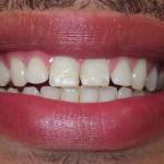 Bling Dental Cosmetic Dentist in Portland