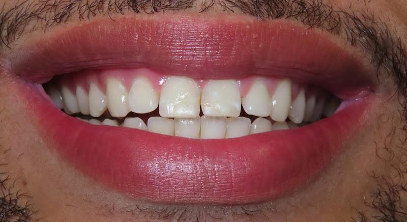 Negocio Bling Dental