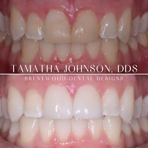 Negocio Brentwood Dental Designs - Tamatha L Johnson Dds