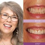 Bright Star Dental Cosmetic Dentist in Las Cruces