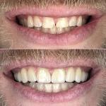 Centerport Cosmetic & Implant Dentistry Cosmetic Dentist in Portland