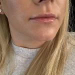 Central Oregon Dental Esthetics Cosmetic Dentist in Redmond