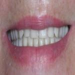 Comfortable Dentistry 4U Cosmetic Dentist in Rio Rancho