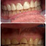 Cornelius Pass Dental Excellence Cosmetic Dentist in Hillsboro