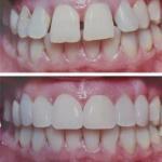 Cornerstone Family Dentistry Cosmetic Dentist in Bend