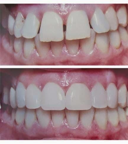 Negocio Cornerstone Family Dentistry