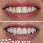 Cosmetic Dental Associates - Medical Center Cosmetic Dentist in San Antonio