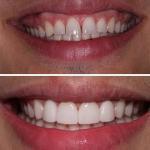 Cosmetic Dentistry Of San Antonio Cosmetic Dentist in San Antonio