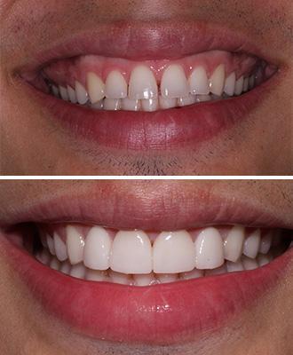 Negocio Cosmetic Dentistry Of San Antonio