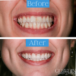 Cowdin Cosmetic Dentistry Cosmetic Dentist in Dallas