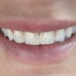 Cranberry Dental Studio Cosmetic Dentist in Cranberry Township