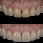 Dental Arts Of Santa Fe Cosmetic Dentist in Santa Fe