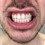 Dental Design Smile Nj Cosmetic Dentist in Jersey City