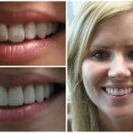 Dentistry By Design Cosmetic Dentist in Columbia