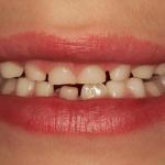 Dr. Aaron M. Shearman Cosmetic Dentist in Butte