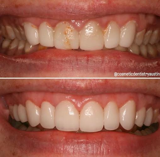 Negocio Dr. John Schmid, D.d.s. Lvif - Contemporary Cosmetic Dentistry