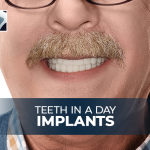 Dr. Russell Kiser Dds Cosmetic Dentist in Mansfield