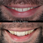 Dublin Metro Dental Cosmetic Dentist in Dublin