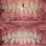 Eastern Slope Dental Cosmetic Dentist in Conway