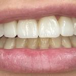 Elite Dental Cosmetic Dentist in Medford