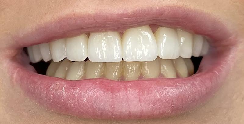 Negocio Elite Dental