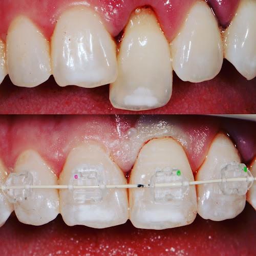 Negocio Esthetic Dentistry Pittsburgh