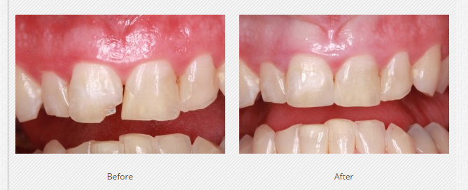 Negocio Felton Dental Care