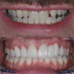 Firouzian Dentistry Cosmetic Dentist in Columbus