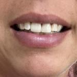 Fixari Family Dental - Lewis Center Cosmetic Dentist in Powell