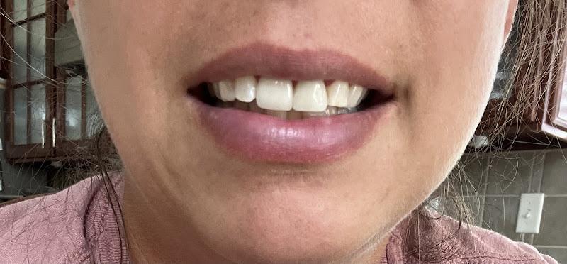 Negocio Fixari Family Dental - Lewis Center