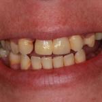 Frontier Family Dental Cosmetic Dentist in Powell