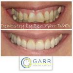 Garr Dental Center Cosmetic Dentist in Carrington
