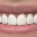 Gentle Dental Rochester Cosmetic Dentist in Rochester